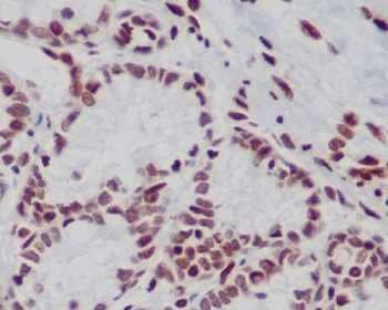 Anti-Histone H3 (mono+di+tri methyl K79) HIST1H3A Rabbit Monoclonal Antibody