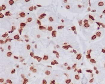 Histone H4 (tri methyl K20) HIST1H4A Rabbit Monoclonal Antibody