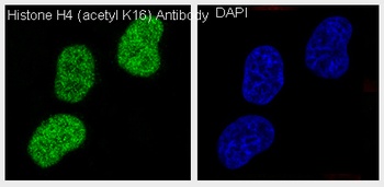 Anti-Histone H4 (acetyl K16) HIST1H4A Monoclonal Antibody