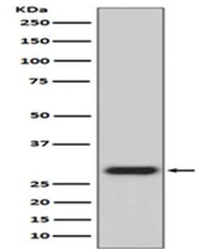 GFP Rabbit Monoclonal Antibody