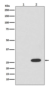 RFP rfp1 Rabbit Monoclonal Antibody