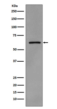 Anti-Phospho-Src (Y419) Monoclonal Antibody