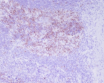 Anti-Phospho-Histone H3 (T3) H3F3A Monoclonal Antibody