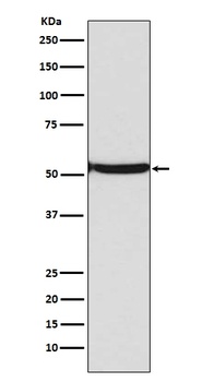 Anti-p53 (acetyl K382) TP53 Rabbit Monoclonal Antibody