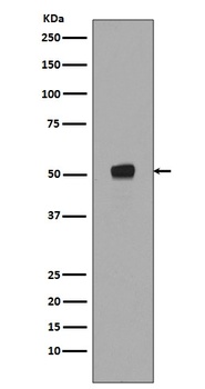Phospho-p53 (S376) TP53 Rabbit Monoclonal Antibody