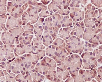 Phospho-STAT3 (Y705) Rabbit Monoclonal Antibody