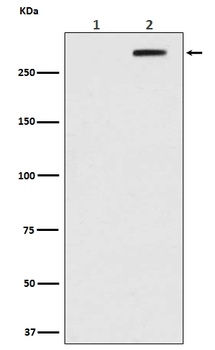 Phospho-ATM (S1981) Rabbit Monoclonal Antibody