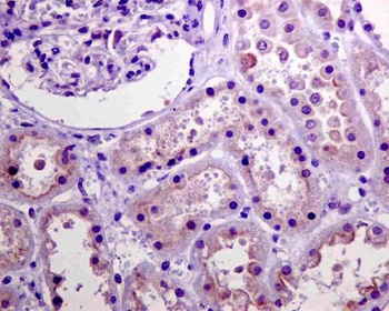 Anti-Phospho-Akt (Ser473) AKT1 Rabbit Monoclonal Antibody