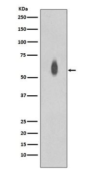 Phospho-c-Myc (T58 + S62) Rabbit Monoclonal Antibody