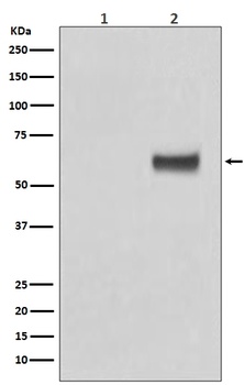Phospho-ER alpha (S118) ESR1 Rabbit Monoclonal Antibody