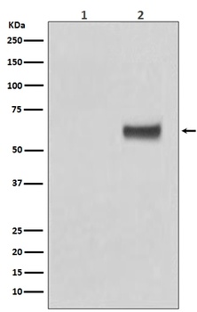 Anti-Phospho-ER alpha (S118) ESR1 Rabbit Monoclonal Antibody