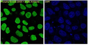 Anti-Phospho-Smad3 (S423 + S425) Rabbit Monoclonal Antibody