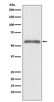 Phospho-Smad2 Rabbit Monoclonal Antibody