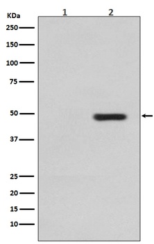 Phospho-Tau (T231) MAPT Rabbit Monoclonal Antibody