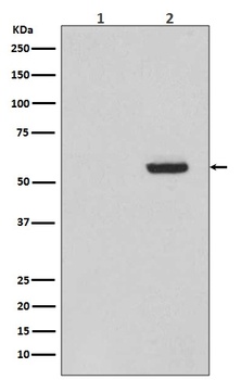 Phospho-Tau (S396) MAPT Rabbit Monoclonal Antibody