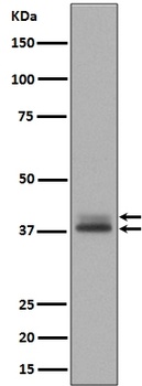Phospho-Erk1 (T202/Y204) + Erk2 (T185/Y187) MAPK3 Rabbit Monoclonal Antibody