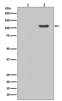 Phospho-FAK (Y397) PTK2 Rabbit Monoclonal Antibody