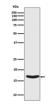 Phospho-alpha Synuclein (S129) SNCA Rabbit Monoclonal Antibody