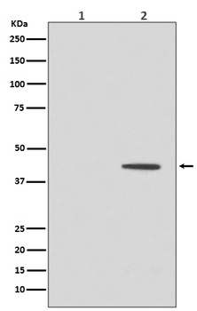 Phospho-MEK1 (T292) MAP2K1 Rabbit Monoclonal Antibody