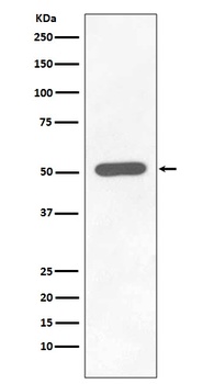 Phospho-Chk1 (S296) CHEK1 Rabbit Monoclonal Antibody