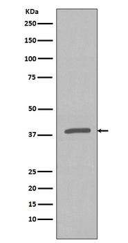 Phospho-IKB alpha (S32) NFKBIA Rabbit Monoclonal Antibody