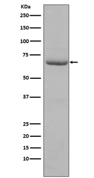 Phospho-PKR (T446) EIF2AK2 Rabbit Monoclonal Antibody