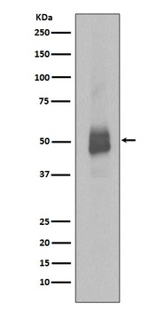 Phospho-Lyn (Y396) Rabbit Monoclonal Antibody