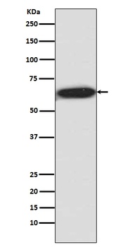 Phospho-S6K1 (T421 + S424) RPS6KB1 Rabbit Monoclonal Antibody