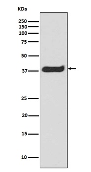 Phospho-LAT (Y191) Rabbit Monoclonal Antibody