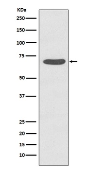 Phospho-PKC zeta (T560) PRKCZ Rabbit Monoclonal Antibody