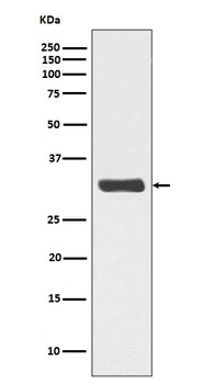 Phospho-RPA2 (T21) Rabbit Monoclonal Antibody