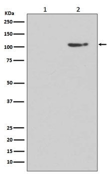Phospho-GluR1 (S845) GRIA1 Rabbit Monoclonal Antibody