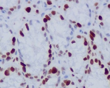 Phospho-Histone H1.4 (T17) HIST1H1E Rabbit Monoclonal Antibody