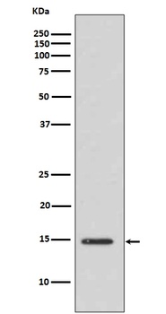 Histone H3 (acetyl K14) HIST1H3A Rabbit Monoclonal Antibody