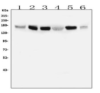 IRS1 Antibody (monoclonal, 10I3)