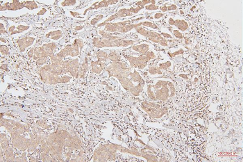 Anti-HMGB1 Antibody (monoclonal, 5H3)