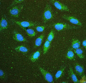 Hexokinase 1/HK1 Antibody