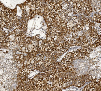 Anti-MTTP Antibody