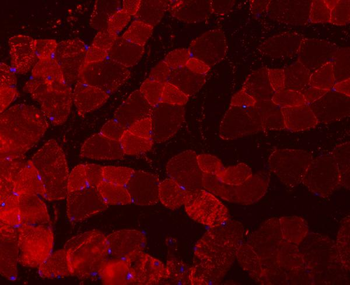 Troponin I fast skeletal muscle/TNNI2 Antibody