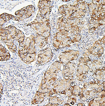 Anti-Aldolase/ALDOA Antibody