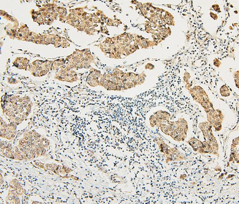 Anti-ATRX Antibody