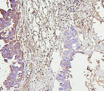 Anti-IRAK-1/IRAK1 Antibody