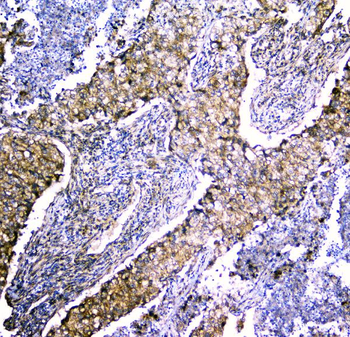 LRTOMT Antibody