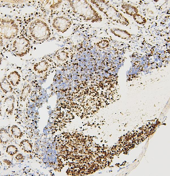 Anti-MCM2 Antibody