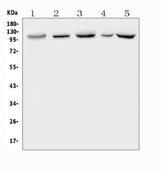 Polycystin 2/PKD2 Antibody