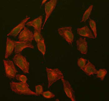 Anti-SUZ12 Antibody