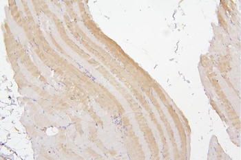 Anti-Tafazzin/TAZ Antibody