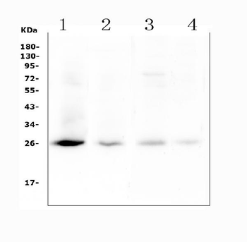 Anti-TIMP1 Antibody