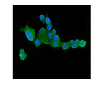 Anti-CLPX Antibody (monoclonal, 11C11)