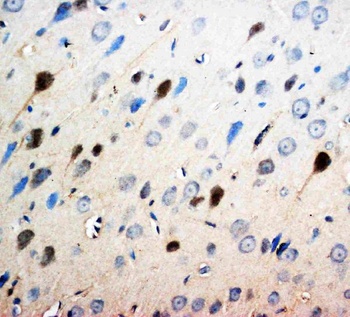 Anti-Neurotrophin 3/NTF3 Antibody